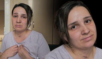 Yaşadığı cehennemi anlattı: Bana ‘mucize kadın’ diyorlar artık